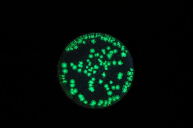 Bakterije+E.+coli+razna%C5%A1ajo+ljudje%2C+ki+si+po+veliki+potrebi+niso+umili+rok+%28foto%3A+Profimedia%29